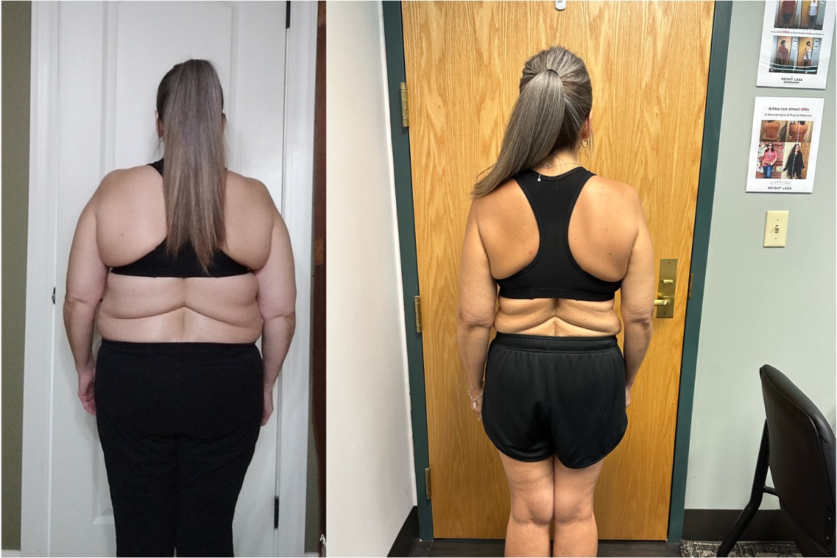 Rachel lost 40 pounds of body fat thanks to Riverside Weight Loss