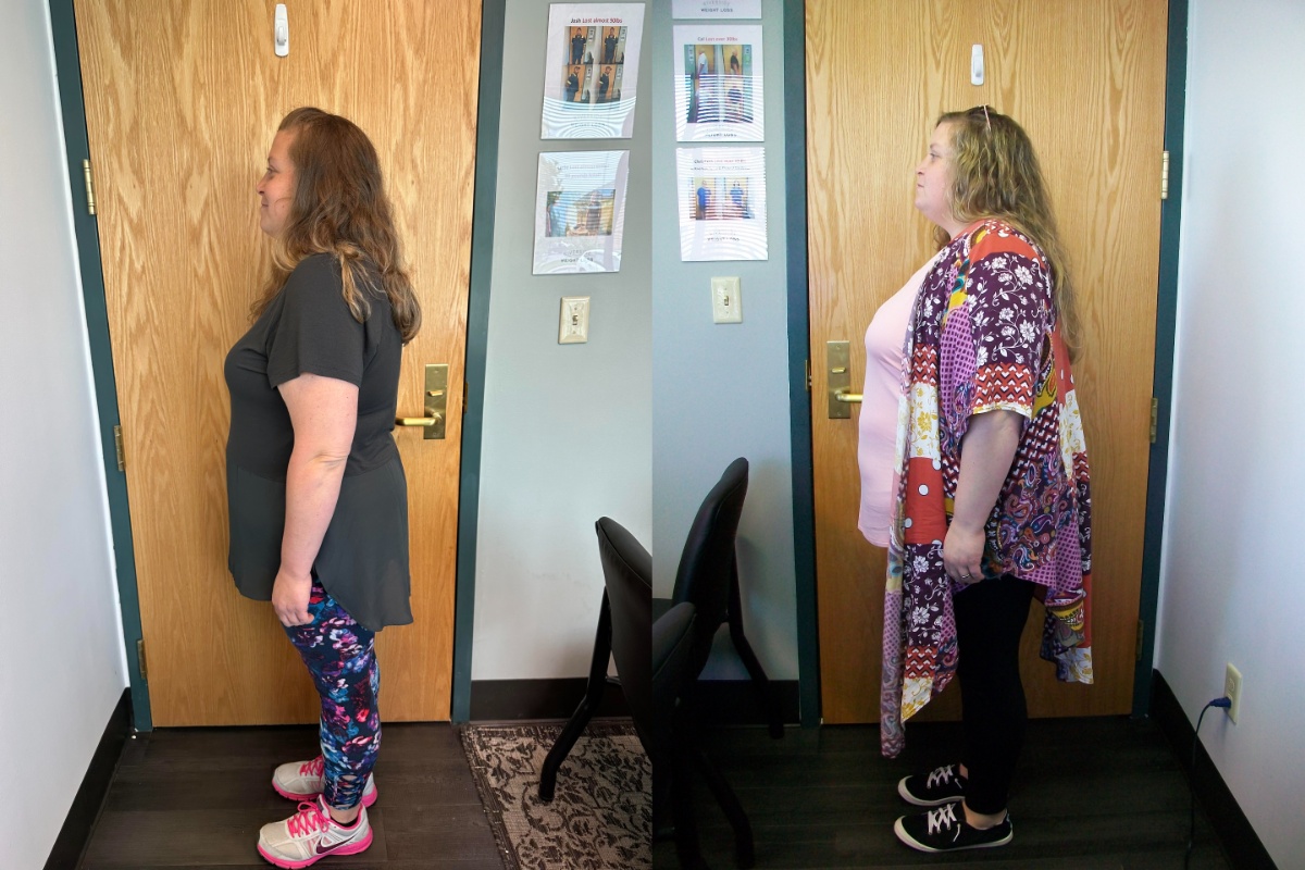 Anna Marie lost 88 pounds with Riverside Weight Loss, back on