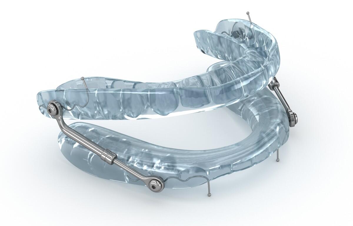 Oral appliance to treat sleep apnea.